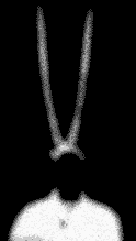 COIL